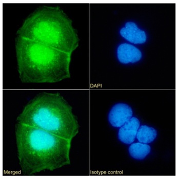 UBE2C Antibody [SAIC-41A-1], Rabbit IgG