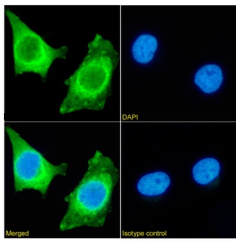 HSPB1 Antibody [SAIC-23E-30], Rabbit IgG