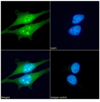 HSPB1 Antibody [SAIC-23B-22], Rabbit IgG