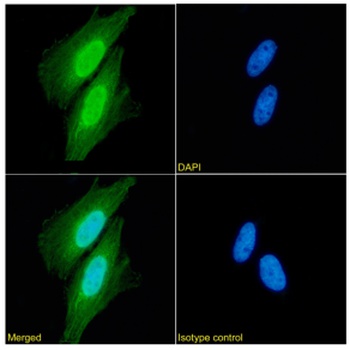 XPNPEP1 Antibody [SAIC-07E-1], Rabbit IgG