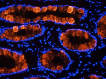 Tumor associated glycoprotein (TAG) 72 Antibody [B72.3 (Satumomab)], Mouse IgG1 - Research Grade Biosimilar