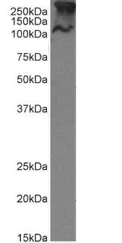 MUC1 Antibody [SM3], Rabbit IgG