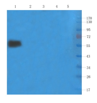 IL-2R alpha (CD25) Antibody [Basiliximab], Human IgG1 - Research Grade Biosimilar