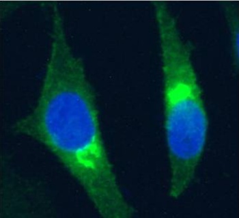 Beta-2 microglobulin Antibody [BBM.1], Rabbit IgG