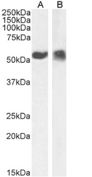 p53 Antibody [PAb421], Rabbit IgG