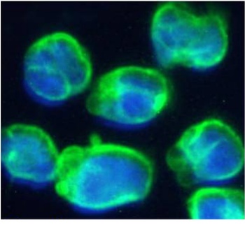 CD3 epsilon Antibody [OKT-3 (muromonab)], Rabbit IgG