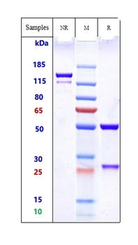 Anti-FOLR1 Reference Antibody (mirvetuximab-MMAE)