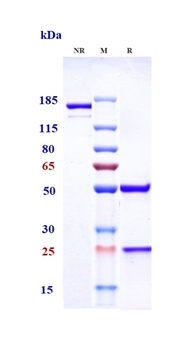 Anti-SLC34A2 Reference Antibody (upifitamab)
