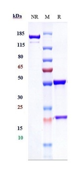 Anti-DCBLD2 / ESDN Reference Antibody (FA19-1)