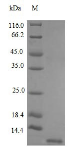Human SDF1 protein (Active)
