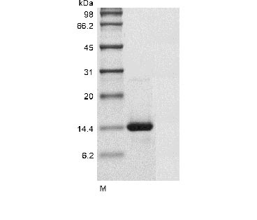 Human GDF5 protein