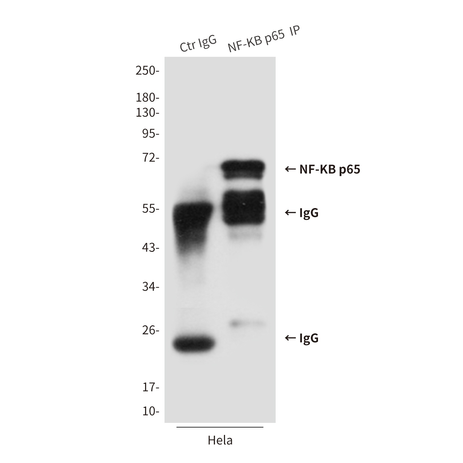NF-KB p65 (3D2) Mouse mAb