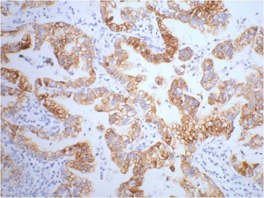 Cytokeratin 7 (9G9) Mouse mAb