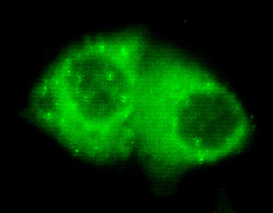 Cytokeratin 7 (4G9) Mouse mAb