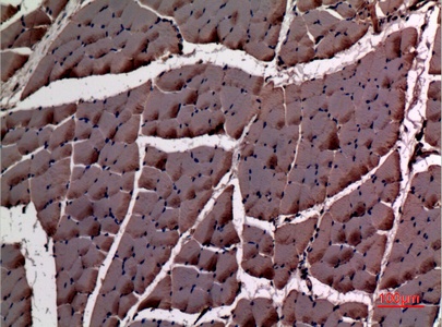ACTC1 Rabbit pAb
