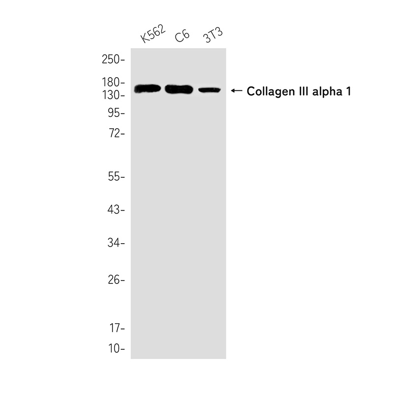 Collagen III alpha 1 Rabbit mAb