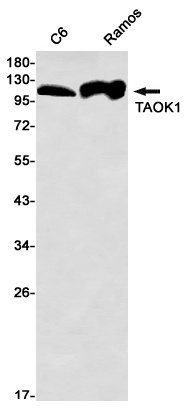 TAOK1 Rabbit mAb