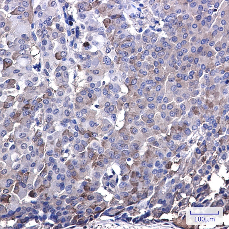 IRF7 Rabbit mAb