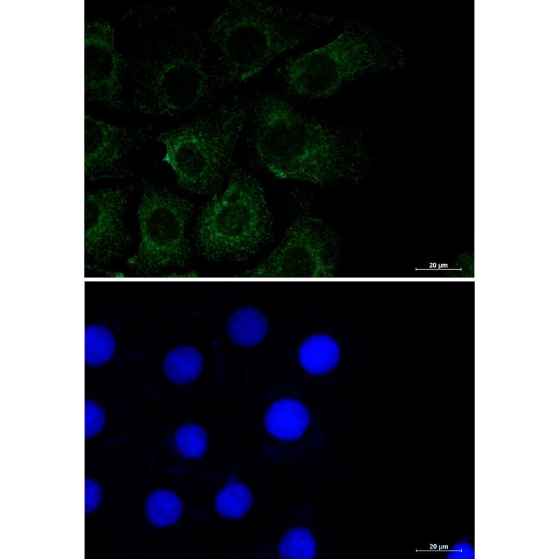 Caveolin 2 Rabbit mAb