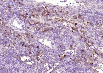 CD2 Mouse Monoclonal Antibody