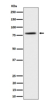 Anti-TORC2 Rabbit Monoclonal Antibody