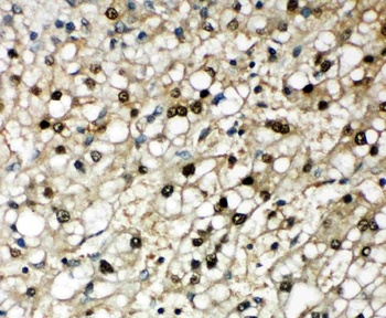 SBP/SELENBP1 Antibody