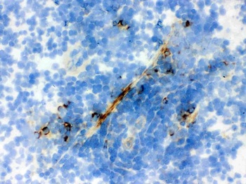 Anti-Actin ACTA1 Antibody (Monoclonal, AC-40)