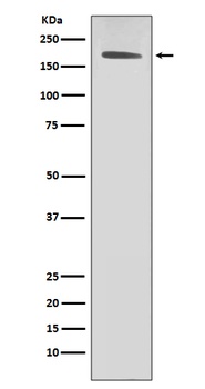 ErbB2 (HER2) Monoclonal Antibody