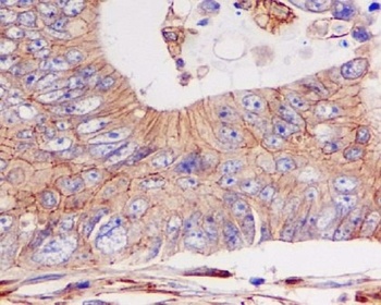 pan Cadherin 1 CDH1 Rabbit Monoclonal Antibody