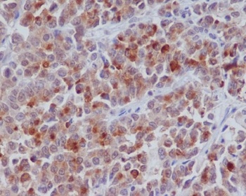 Cyclin B1 CCNB1 Rabbit Monoclonal Antibody