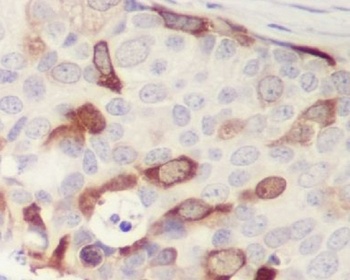 Cyclin B1 CCNB1 Rabbit Monoclonal Antibody