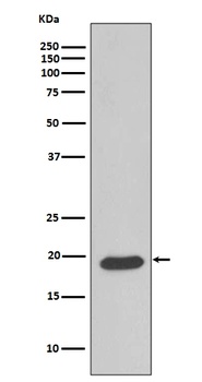 Caveolin-3 CAV3 Rabbit Monoclonal Antibody