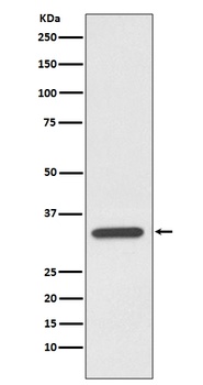pro Caspase 7 CASP7 Rabbit Monoclonal Antibody