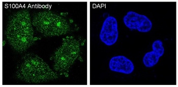 S100A4 Rabbit Monoclonal Antibody