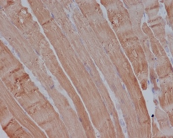 Actin (Alpha-Actin) ACTA1 Rabbit Monoclonal Antibody