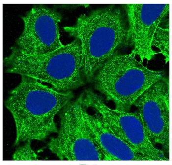 Actin (Alpha-Actin) ACTA1 Rabbit Monoclonal Antibody