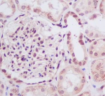 UBE2I/Ubc9 Rabbit Monoclonal Antibody