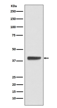 Islet 1 Rabbit Monoclonal Antibody
