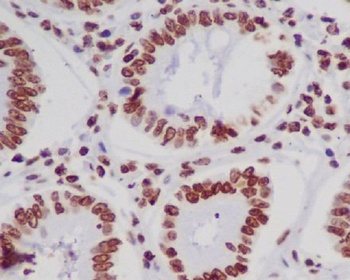Histone H4 (acetyl K5) HIST1H4A Monoclonal Antibody
