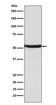 p53 (acetyl K382) TP53 Rabbit Monoclonal Antibody