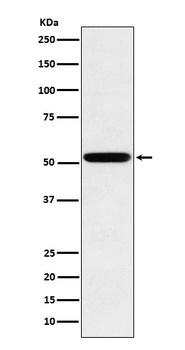 Human IgG2 Rabbit Monoclonal Antibody