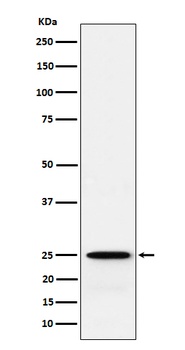 GSTK1 Rabbit Monoclonal Antibody
