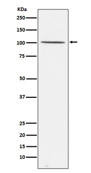 Gemin 3 Rabbit Monoclonal Antibody