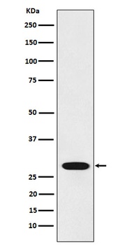 RCHY1 Rabbit Monoclonal Antibody
