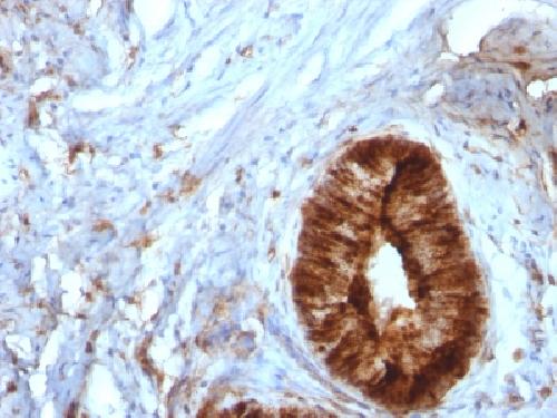 Beta-2 Microglobulin (Renal Failure & Tumor Marker) Antibody