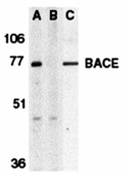 BACE Antibody