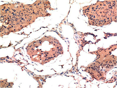 BAX Monoclonal Antibody