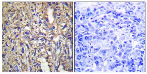LAMB1 Antibody
