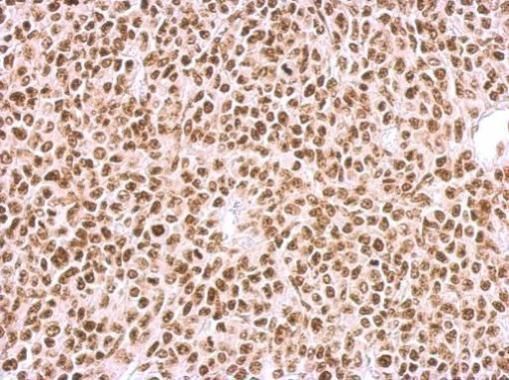BCCIP antibody