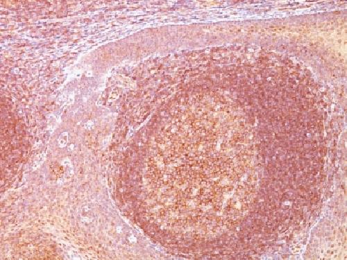 BCL10 (MALT-Lymphoma Marker) Antibody